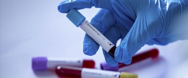 Coronavirus: 114.367 muertos y 5.238.610 contagiados en la Argentina