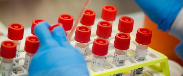 Coronavirus: 114.684 muertos y 5.245.265 contagiados en la Argentina