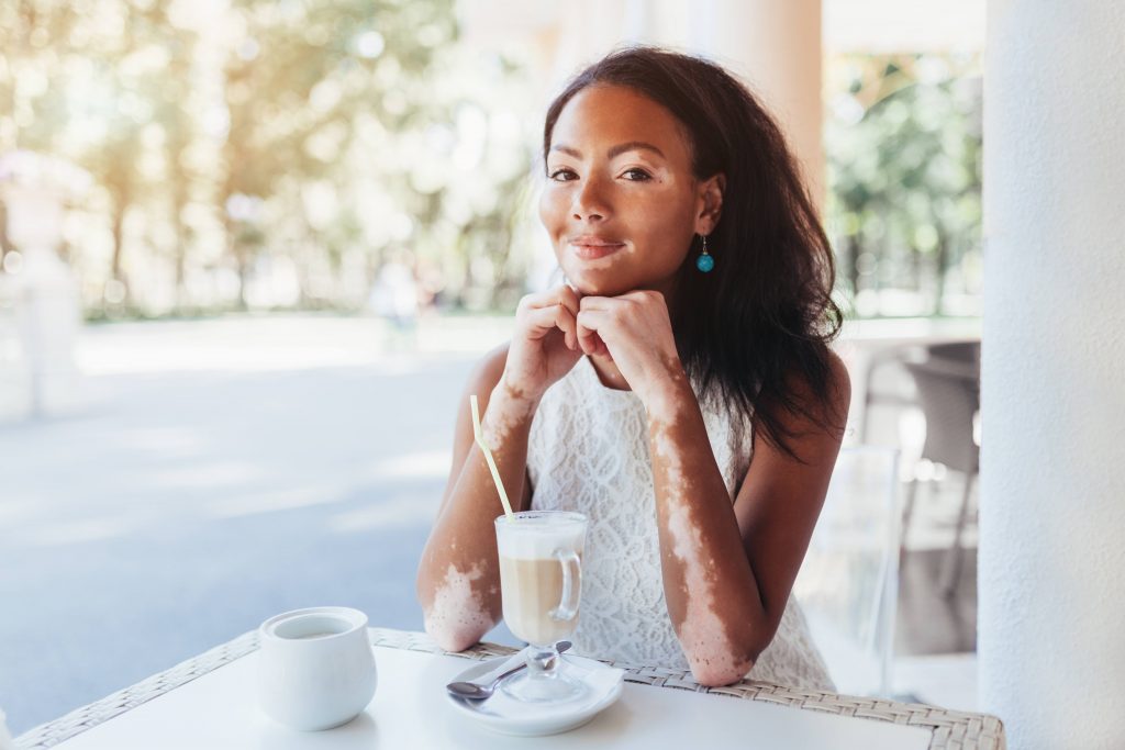 Día Mundial del Vitiligo