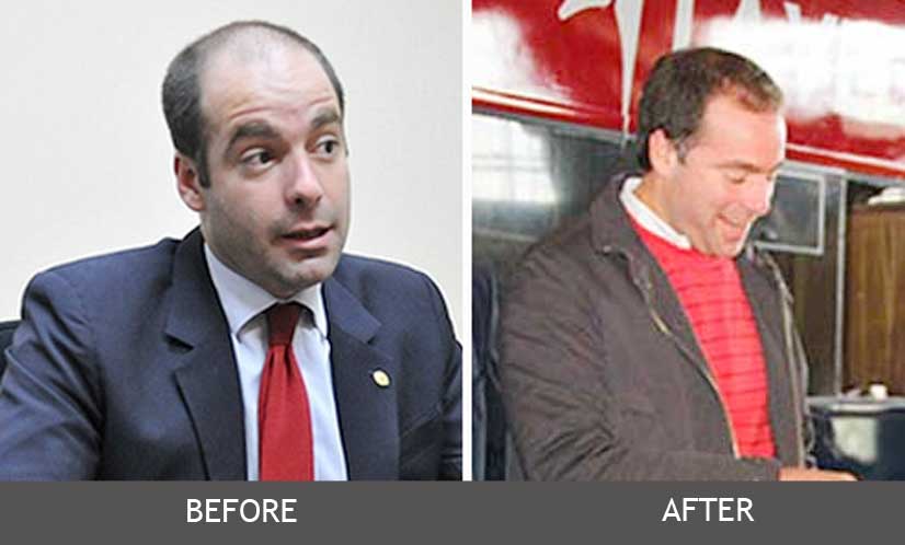 Un antes y un después de #Arbolate mt_nothumb